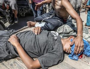 Gazze’de misyon yapan Amerikalı doktor: Kafasından vurulmuş çocuklar gördüm