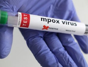 Avrupa’da maymun çiçeği virüsü uyarısı: Hazırlıklı olun!