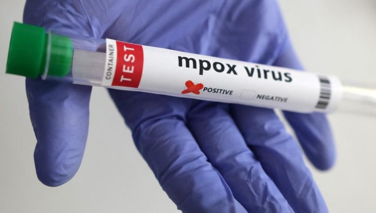 Avrupa’da maymun çiçeği virüsü uyarısı: Hazırlıklı olun!