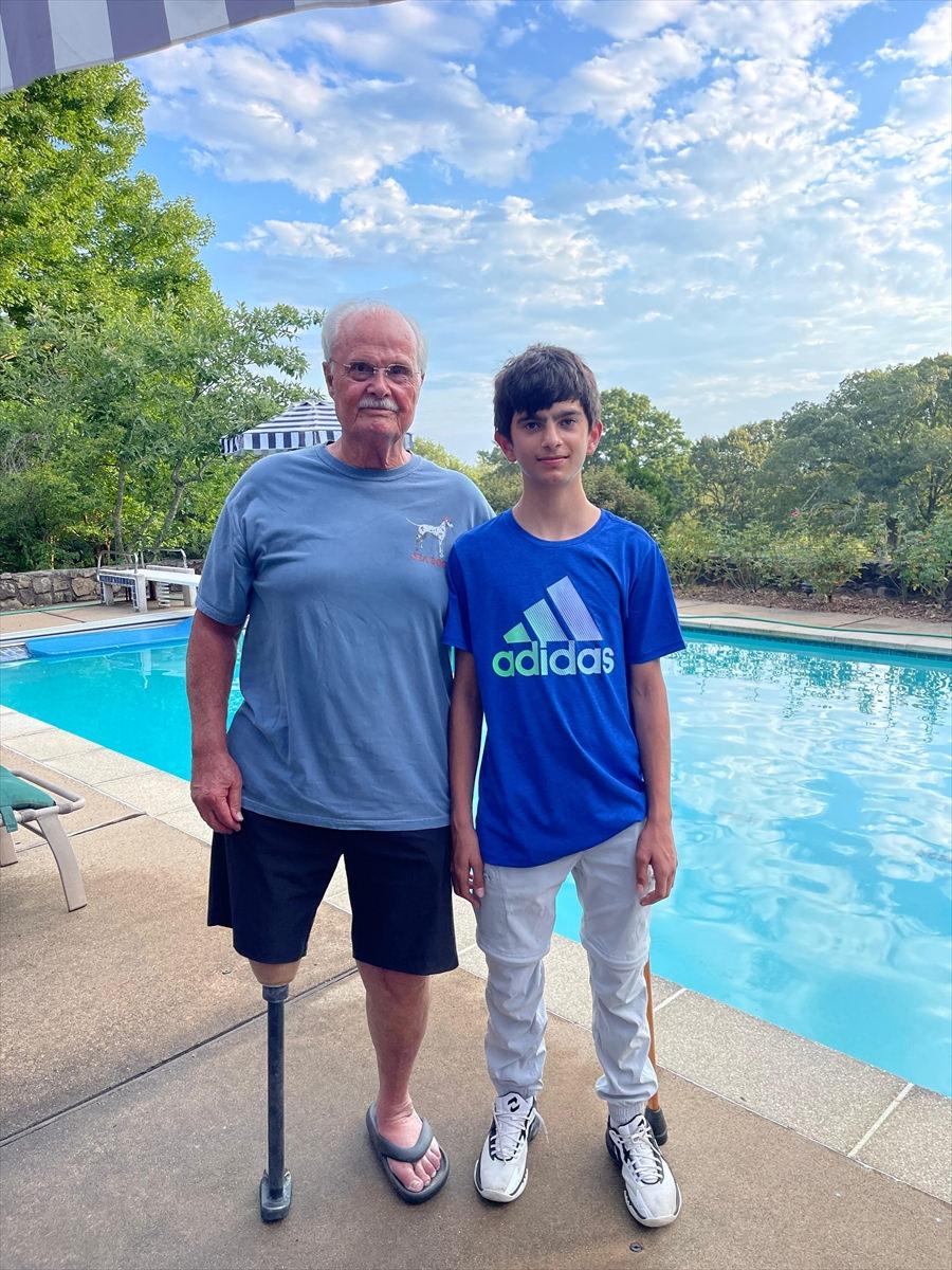 “Hemimelia”, Amerikalı hekimle Afgan çocuk hastasını bir ortaya getirdi