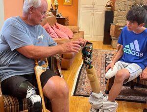 “Hemimelia”, Amerikalı hekimle Afgan çocuk hastasını bir ortaya getirdi