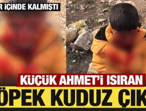 Adıyaman’da küçük Ahmet’i ısıran köpek kuduz çıktı