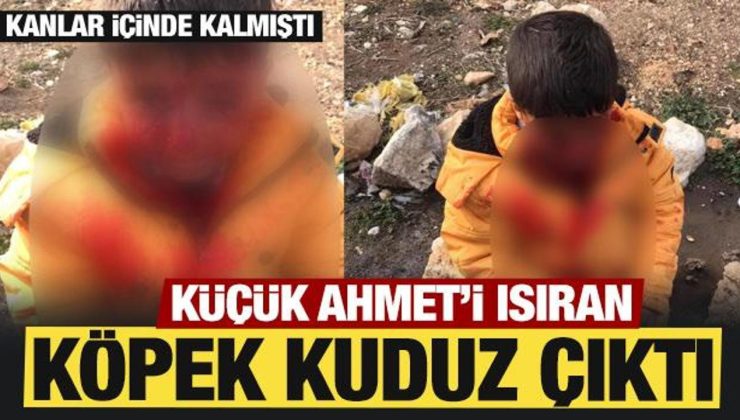 Adıyaman’da küçük Ahmet’i ısıran köpek kuduz çıktı