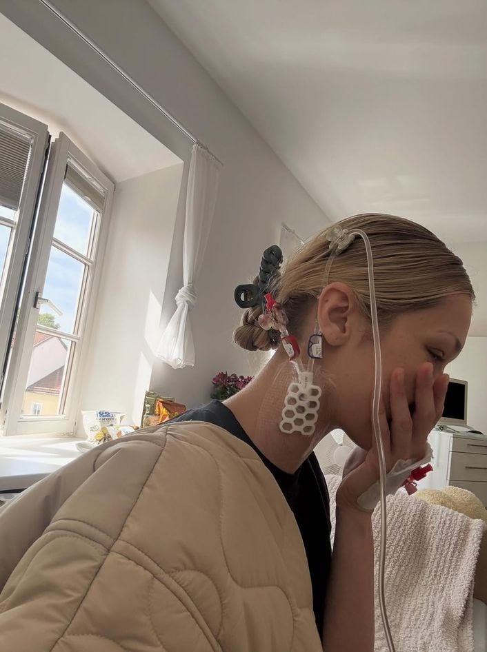 Bella Hadid Lyme hastalığıyla gayretini paylaştı