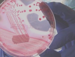 Erkeklerde en çok görülen ikinci kanser tipi aşikâr oldu