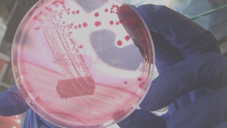 Erkeklerde en çok görülen ikinci kanser tipi aşikâr oldu