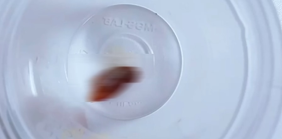 Bir buçuk yıldır geçmeyen öksürüğün nedenini öğrenince şoke oldu
